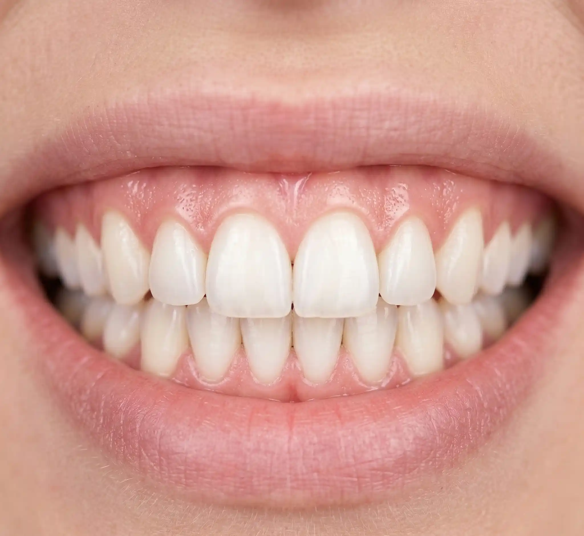 Estetski Zahvat - Poslije